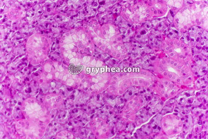 Parathyroïde x100 - gryphea.com